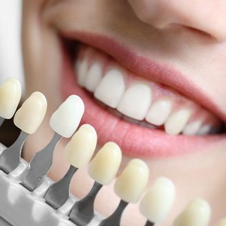 Professional whitening is faster than cheap methods available at most stores