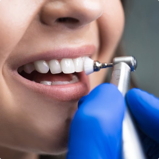 Close up of person receiving a dental cleaning