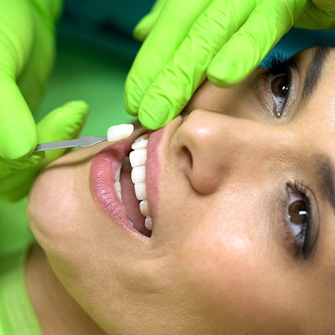 Woman getting veneers